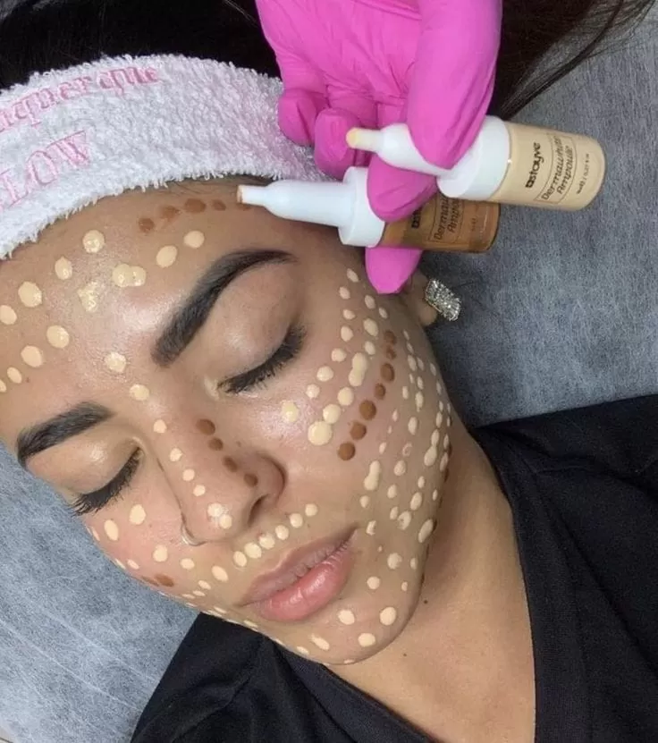 Lifting Lymphatic Drainage