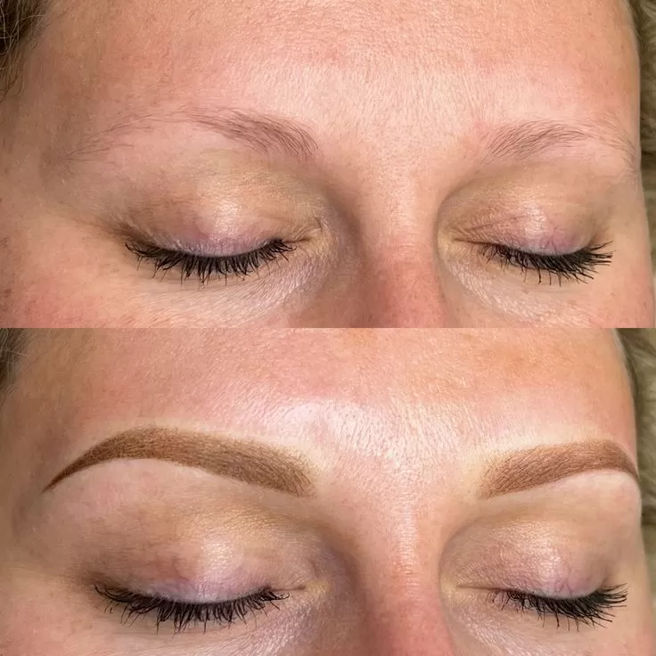 Lifting Lymphatic Drainage