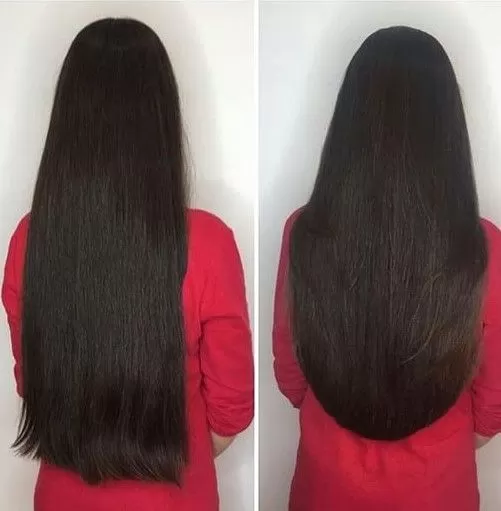 Lifting Lymphatic Drainage