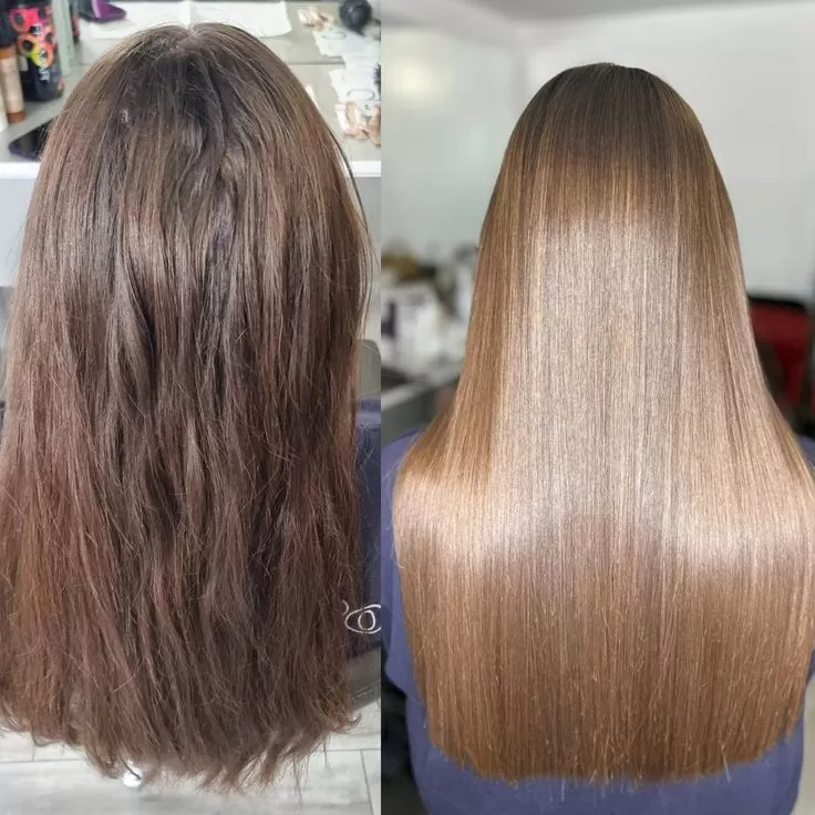 Lifting Lymphatic Drainage